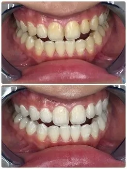 まずはお試しコース！