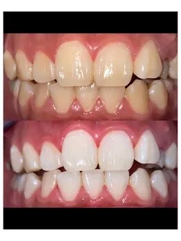 お時間のない方へ◎