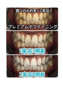 早く白くしたい方へ◎