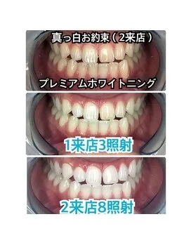  タバコやコーヒーでの黄ばみに◎