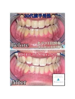 未経験の方にはお試し！