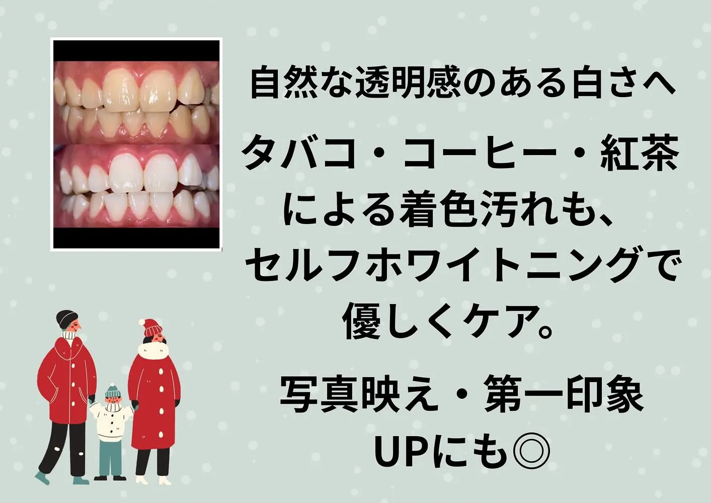 ☃️冬の間に、歯の白さ底上げしませんか？☃️