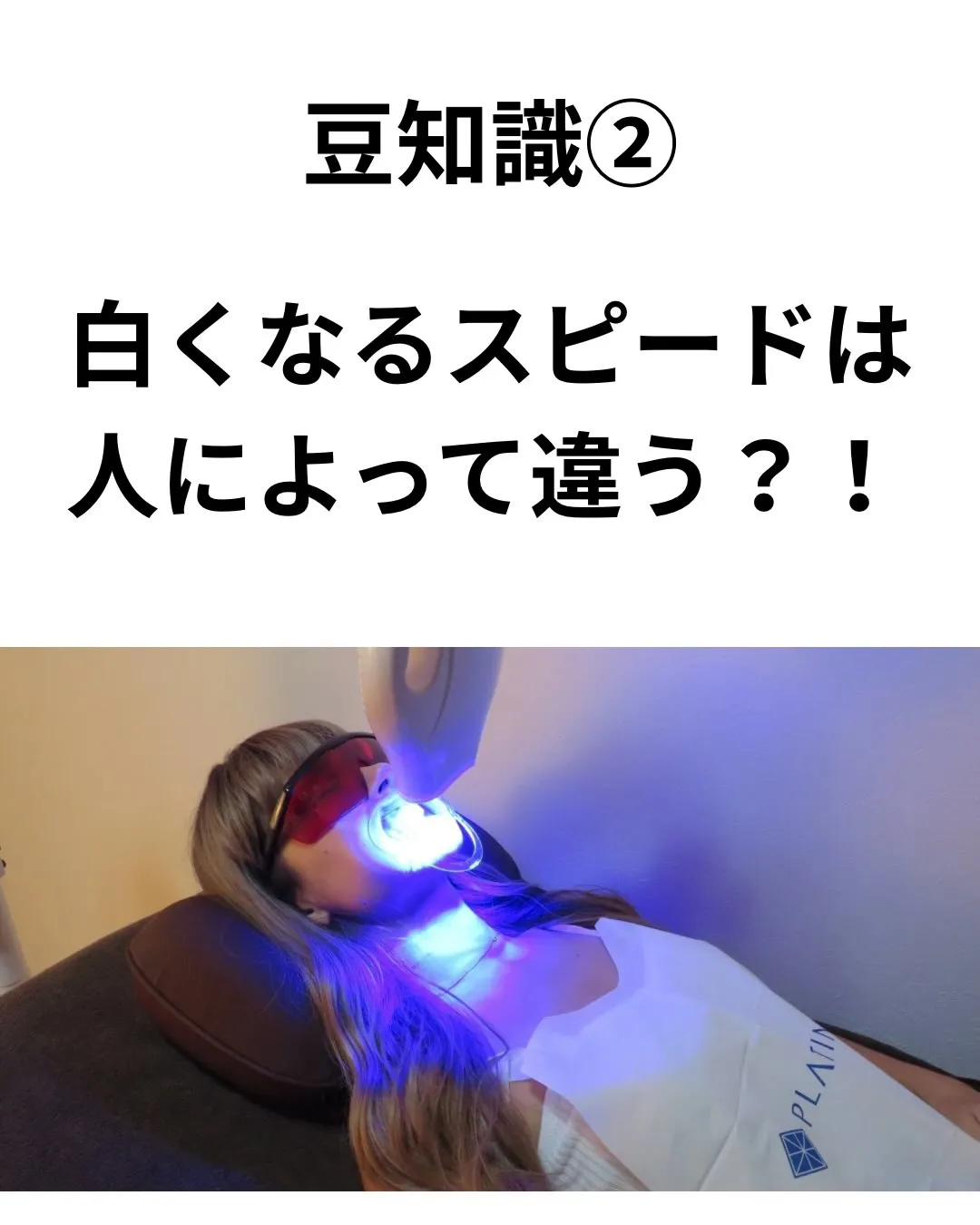 🦷セルフホワイトニングの豆知識🦷