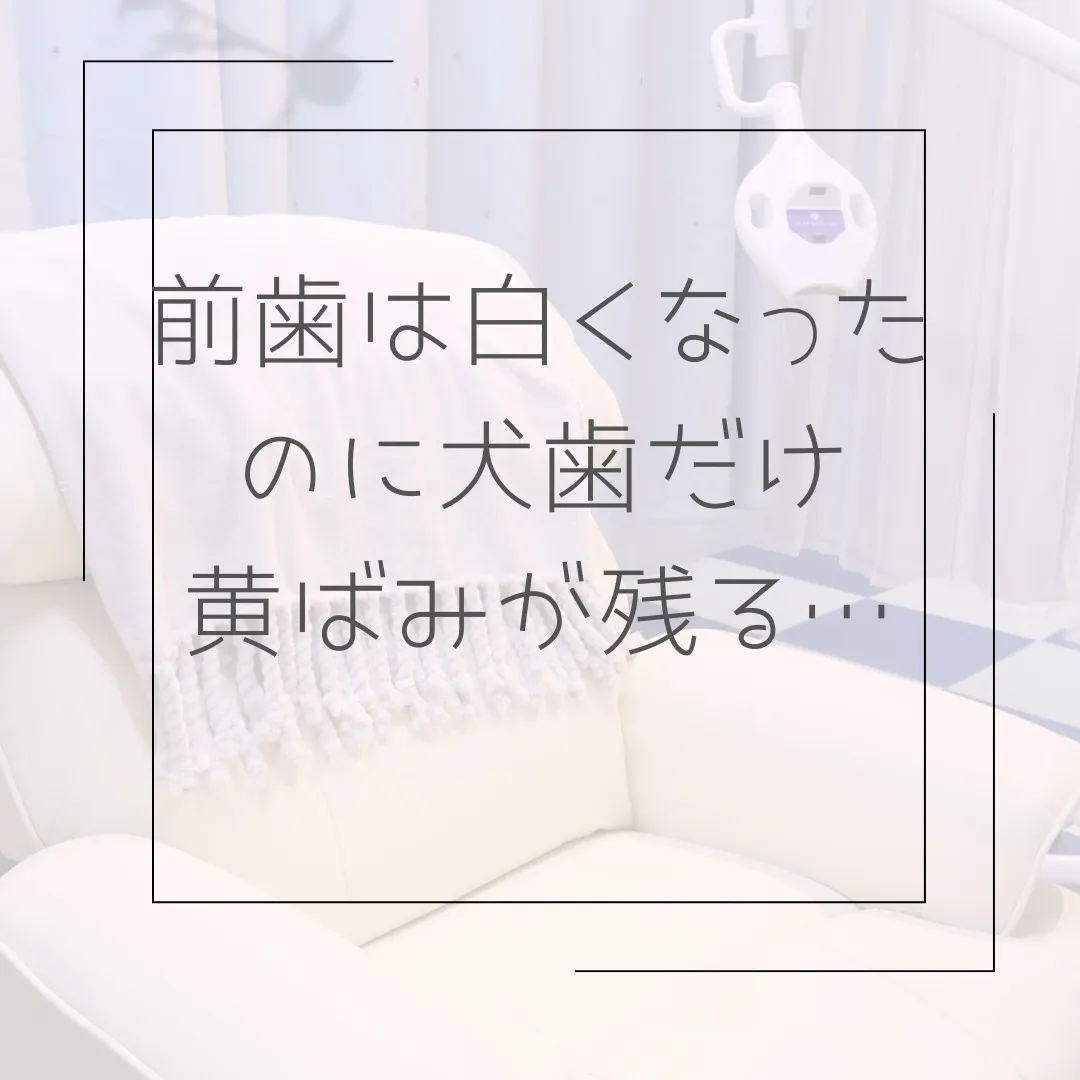 犬歯の黄ばみ気になりませんか？