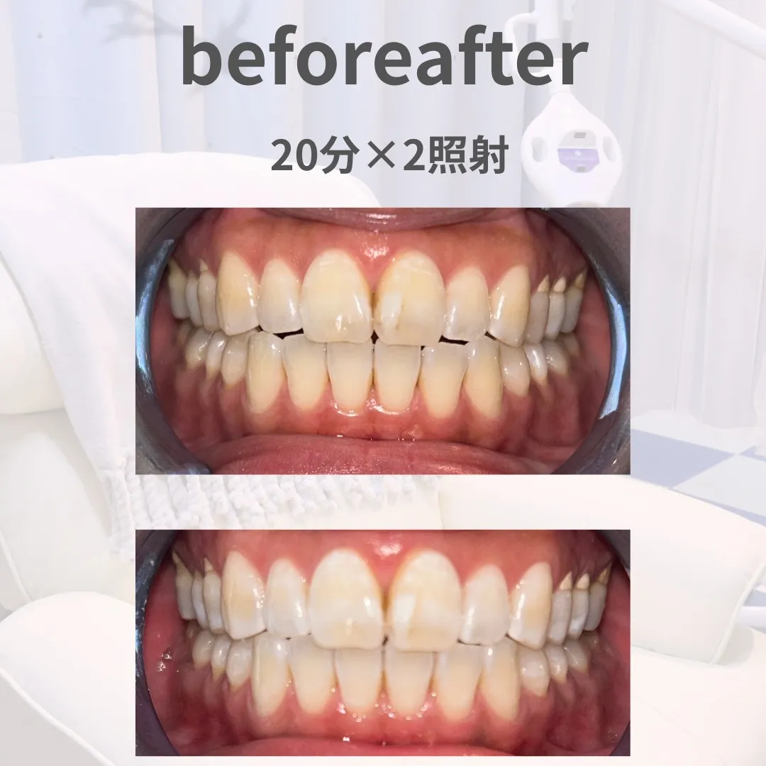リピーター様のBefore→After📸